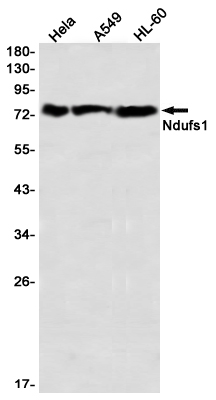 NDUFS1