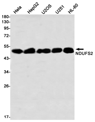NDUFS2