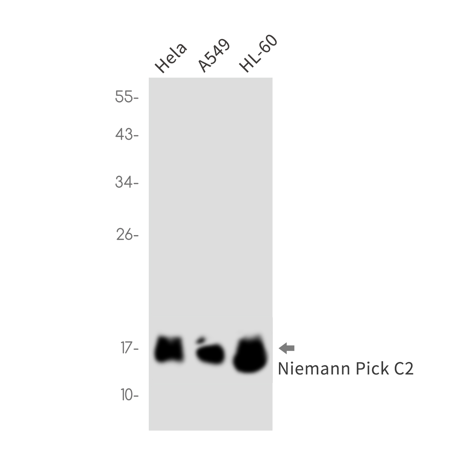 Rabbit Monoclonal Antibody to Niemann Pick C2