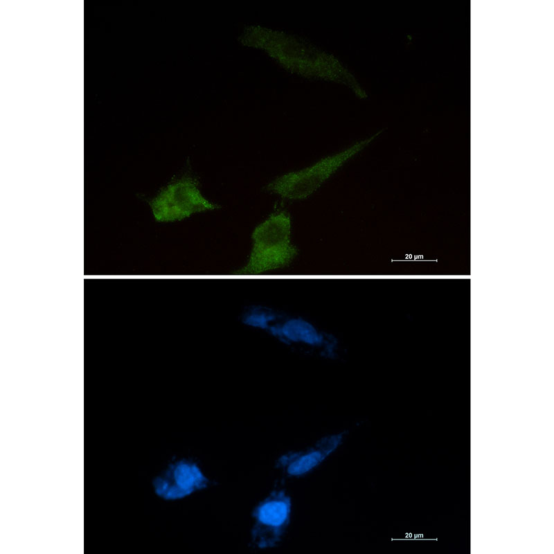 Rabbit Monoclonal Antibody to Niemann Pick C2