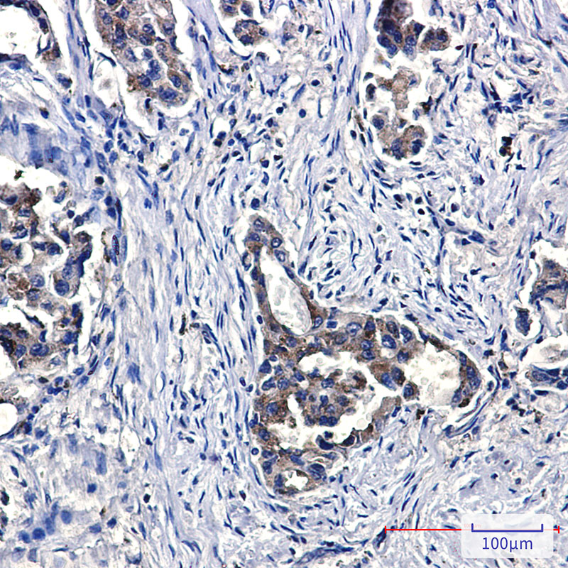Rabbit Monoclonal Antibody to Niemann Pick C2