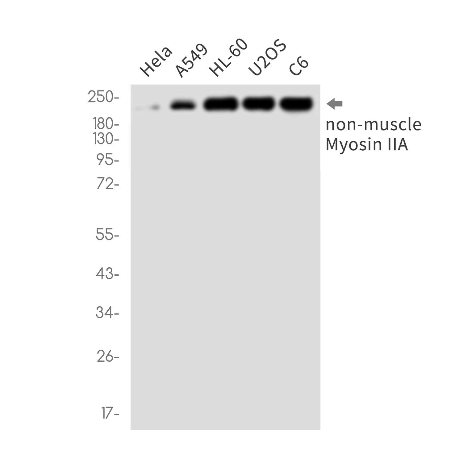 MYH9