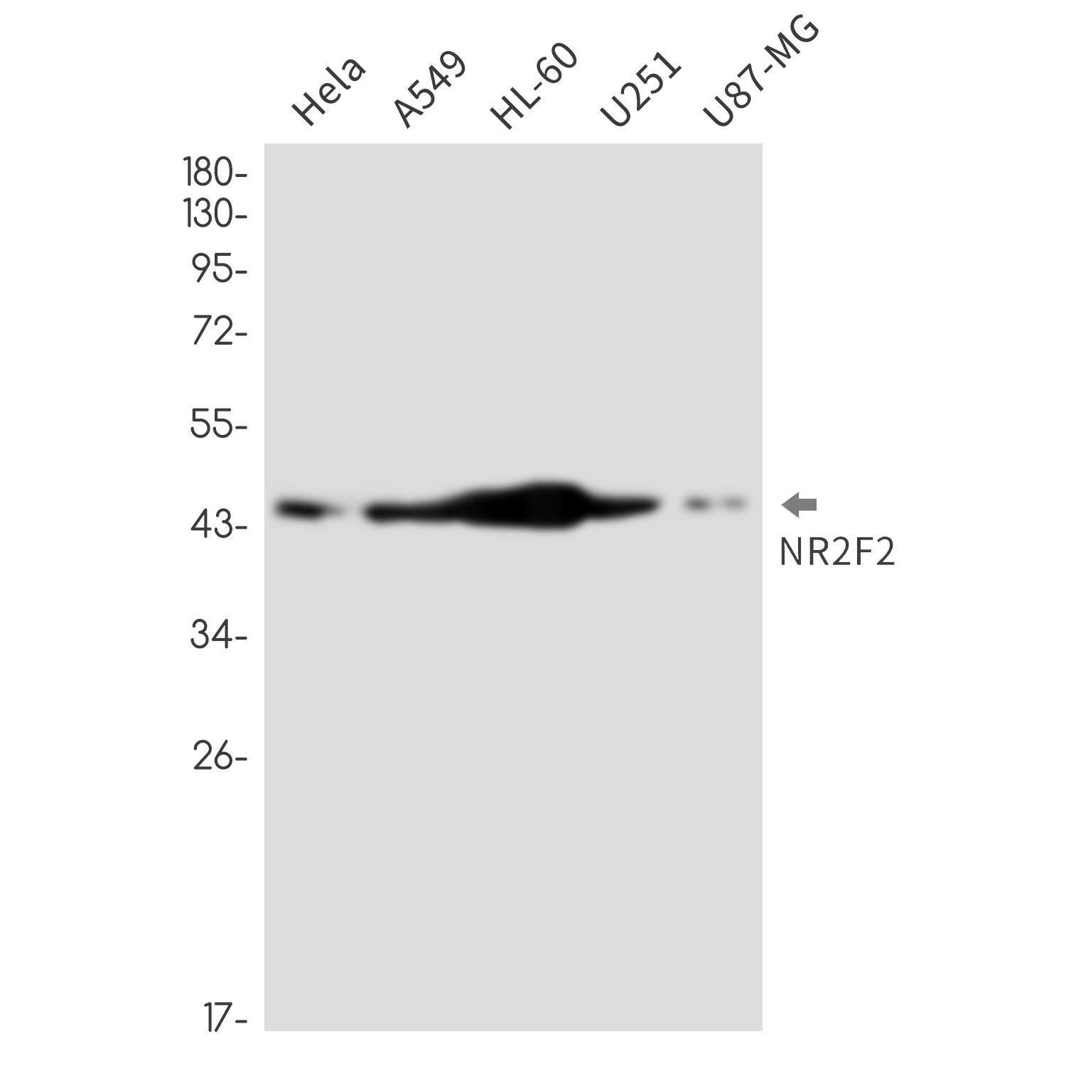 NR2F2
