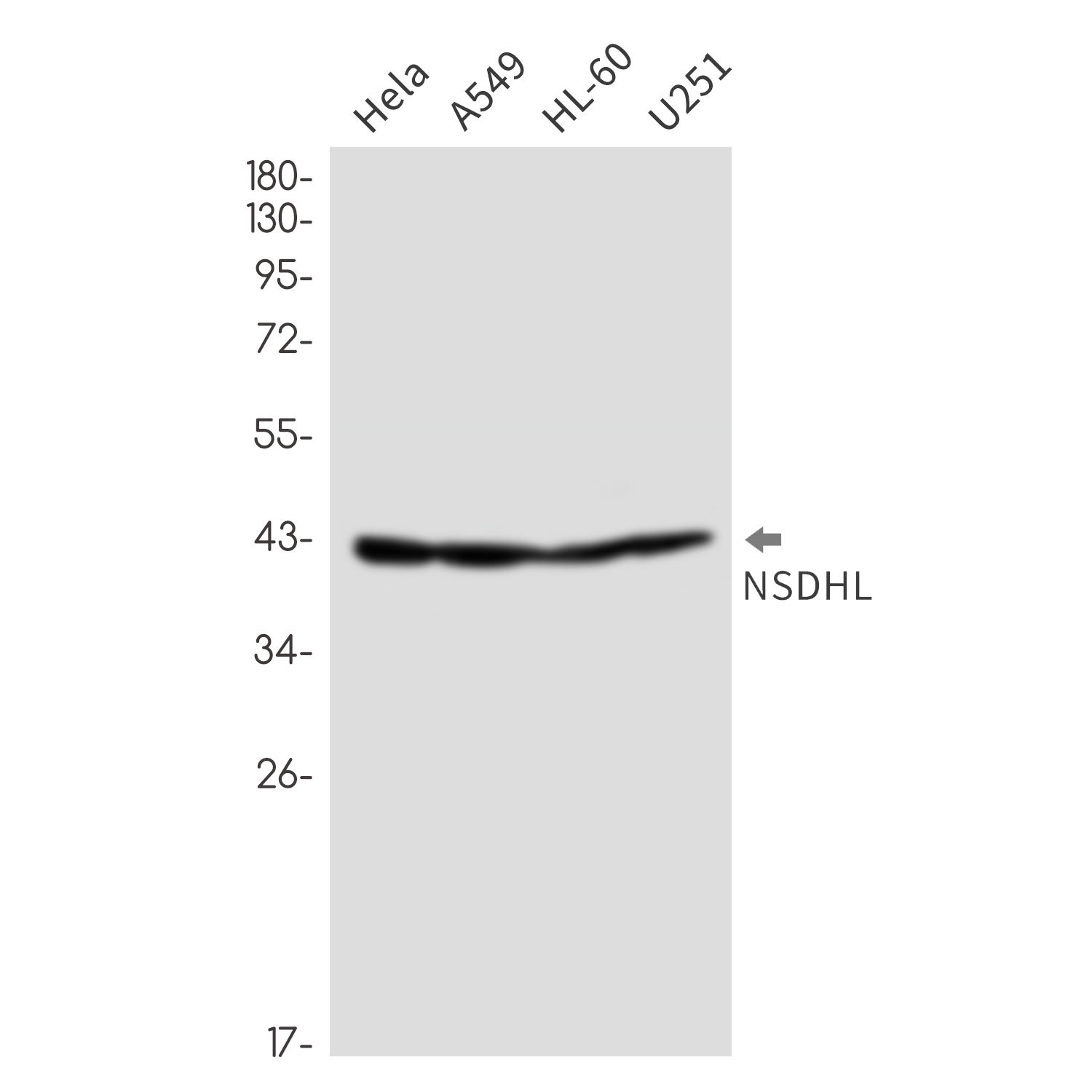 NSDHL