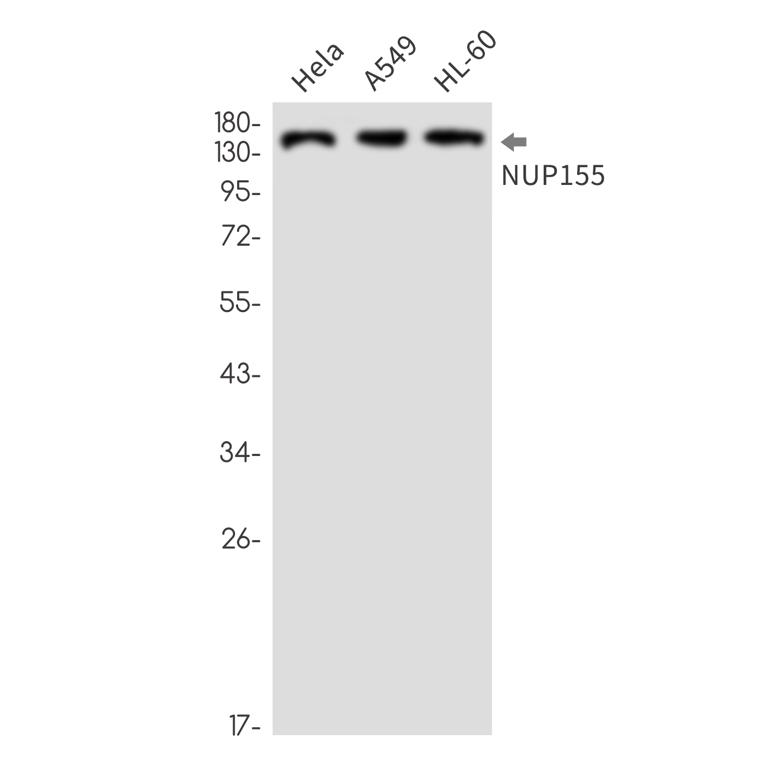 NUP155