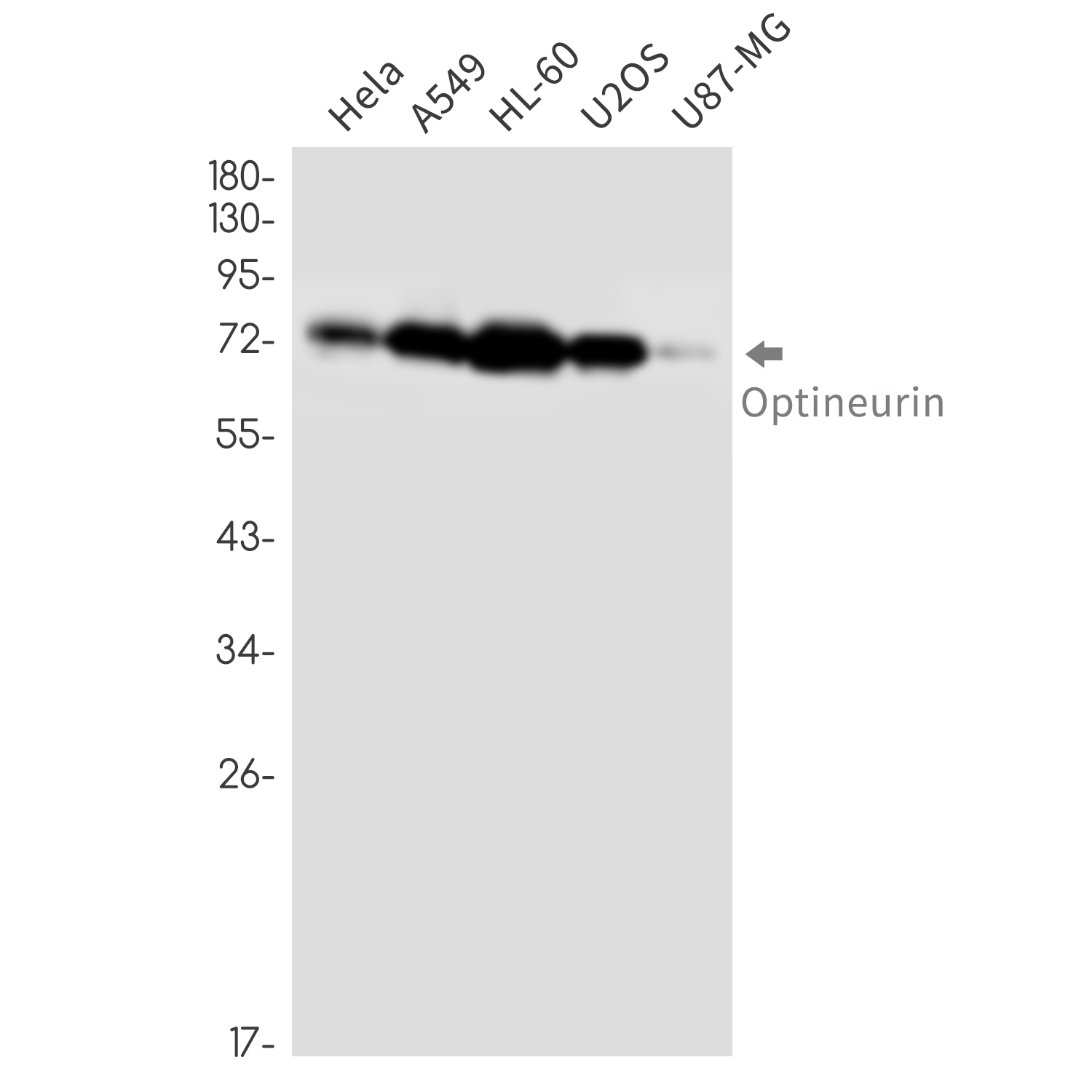 Optineurin