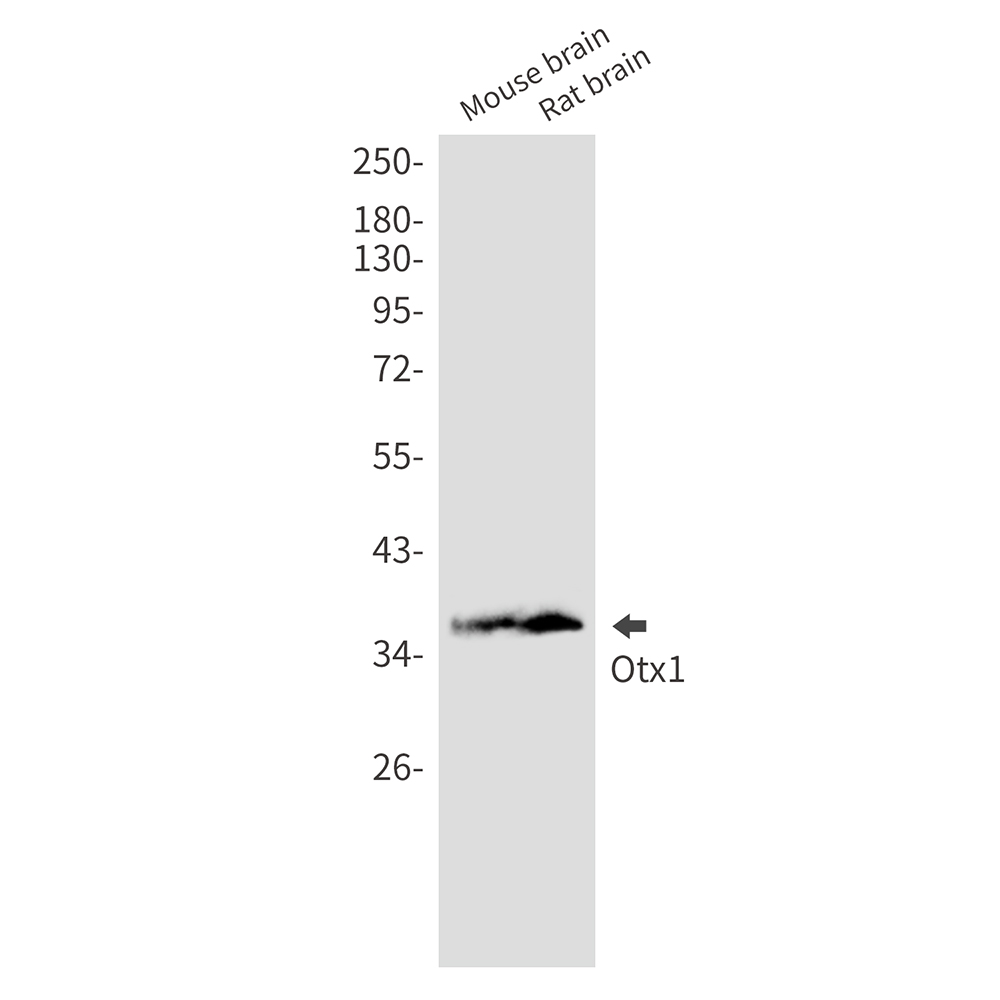 OTX1