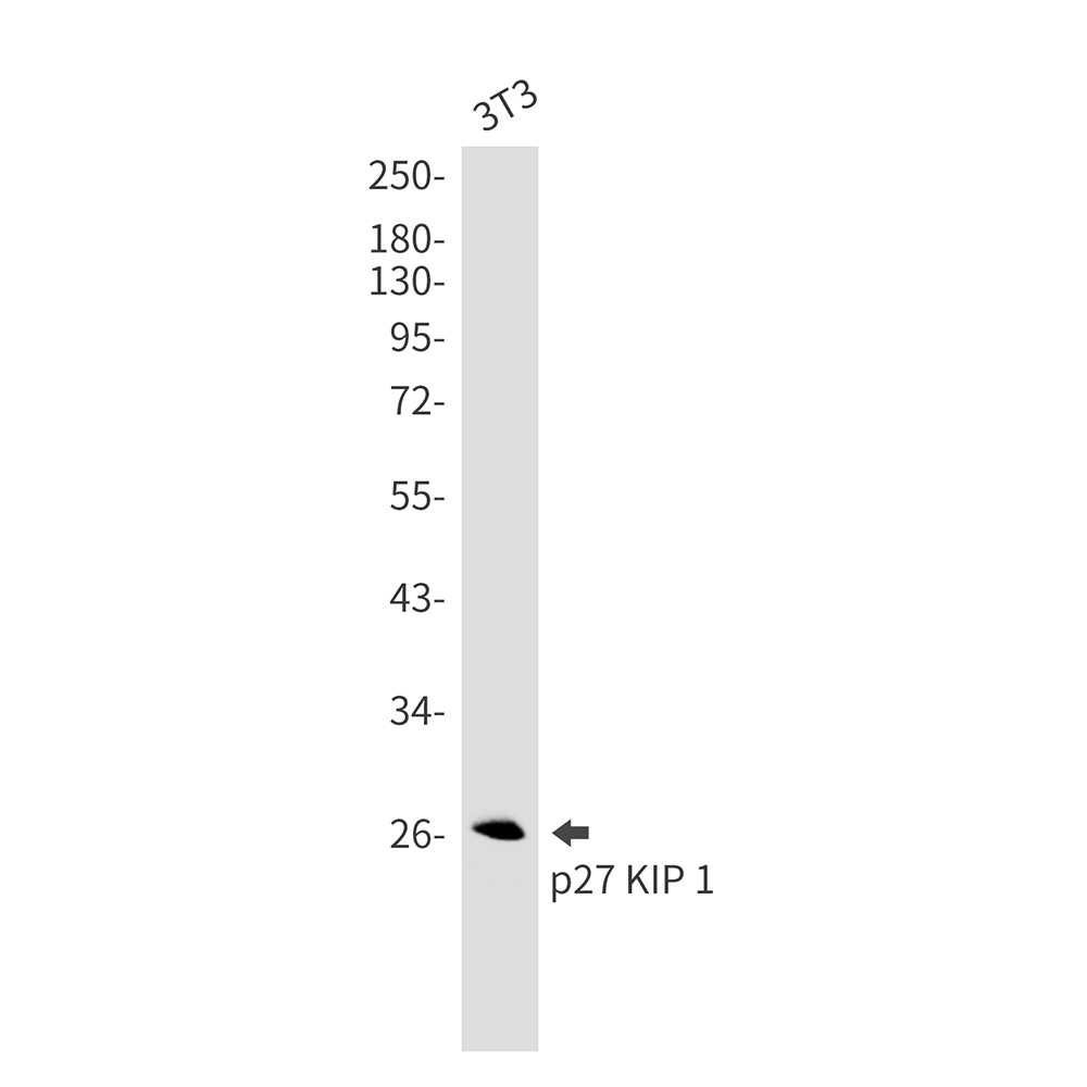 p27 Kip 1