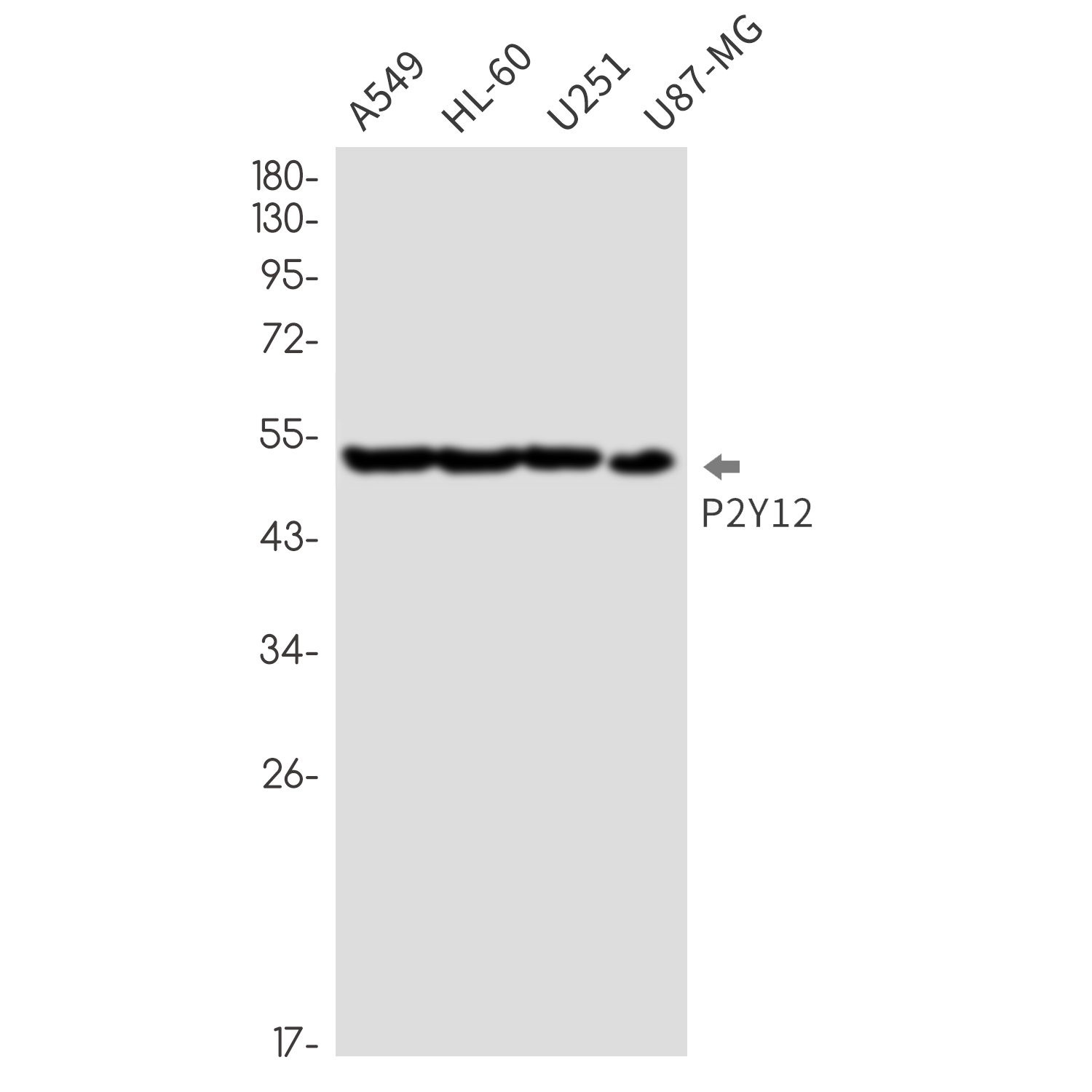 P2Y12