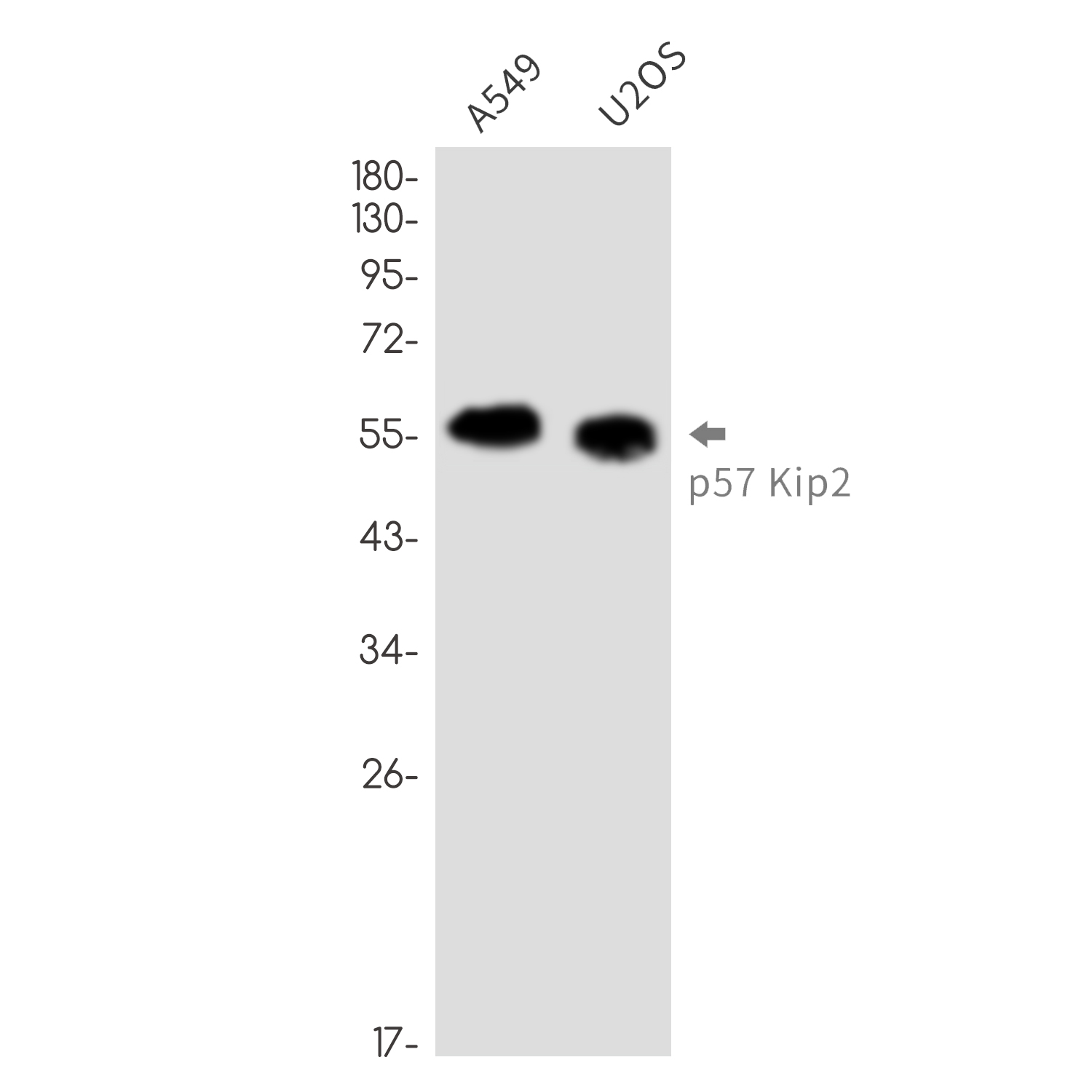 p57 Kip2