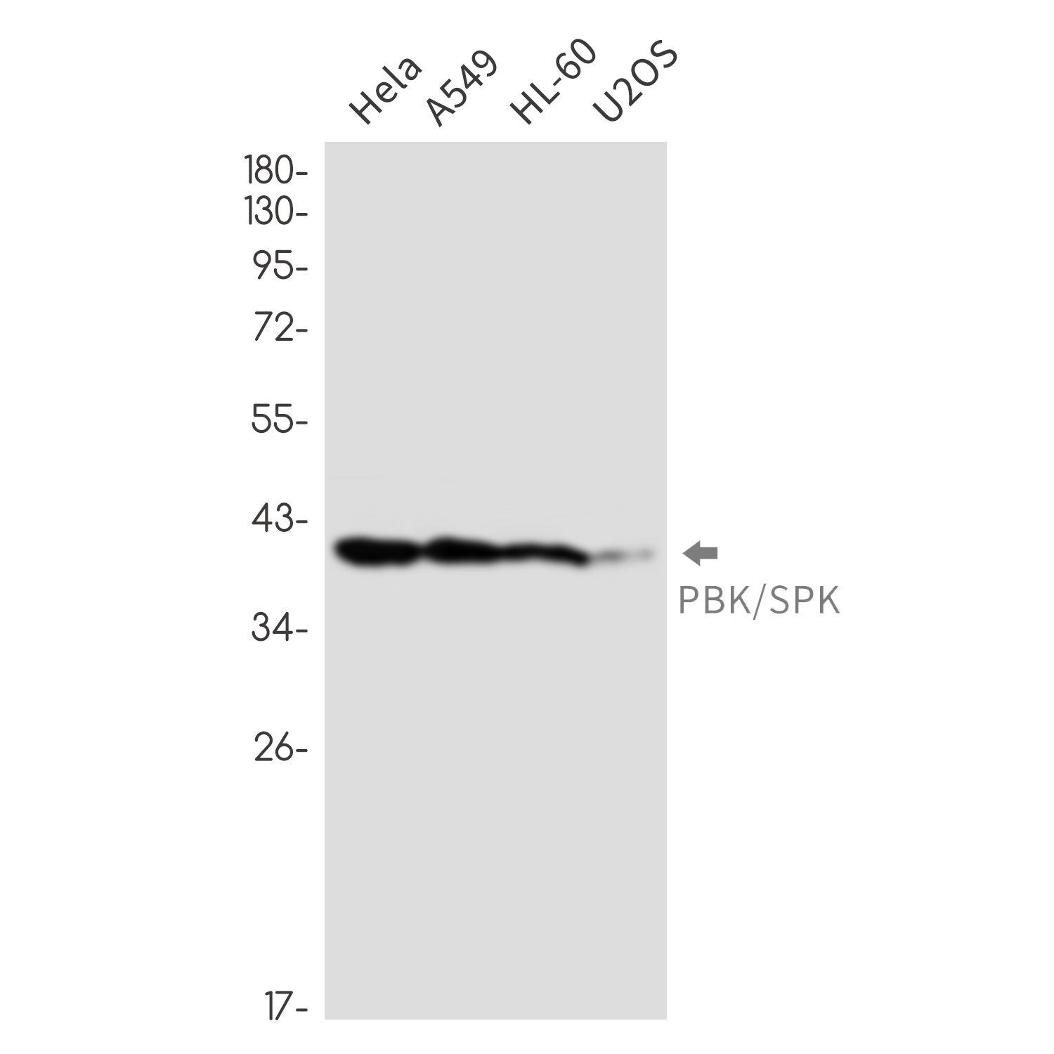 Rabbit Monoclonal Antibody to PBK