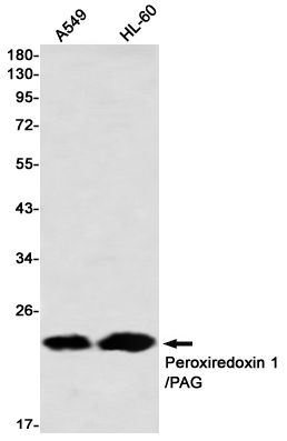 Peroxiredoxin 1