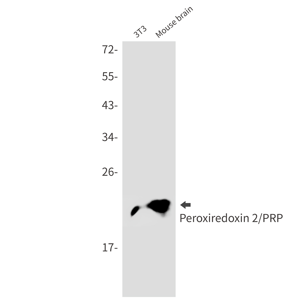 Peroxiredoxin 2