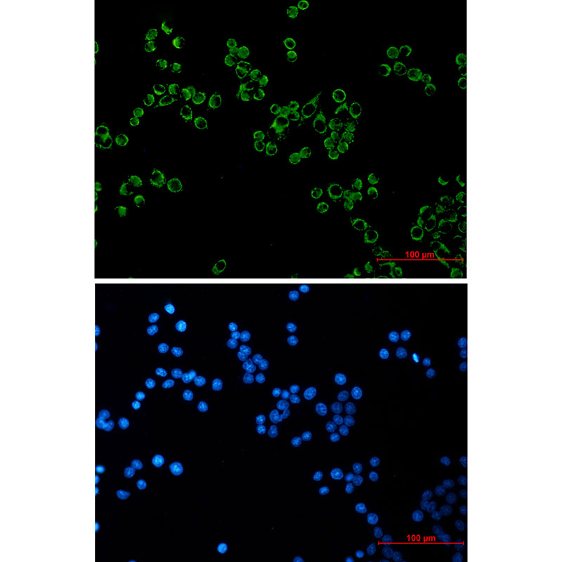 Rabbit Monoclonal Antibody to Peroxiredoxin 3