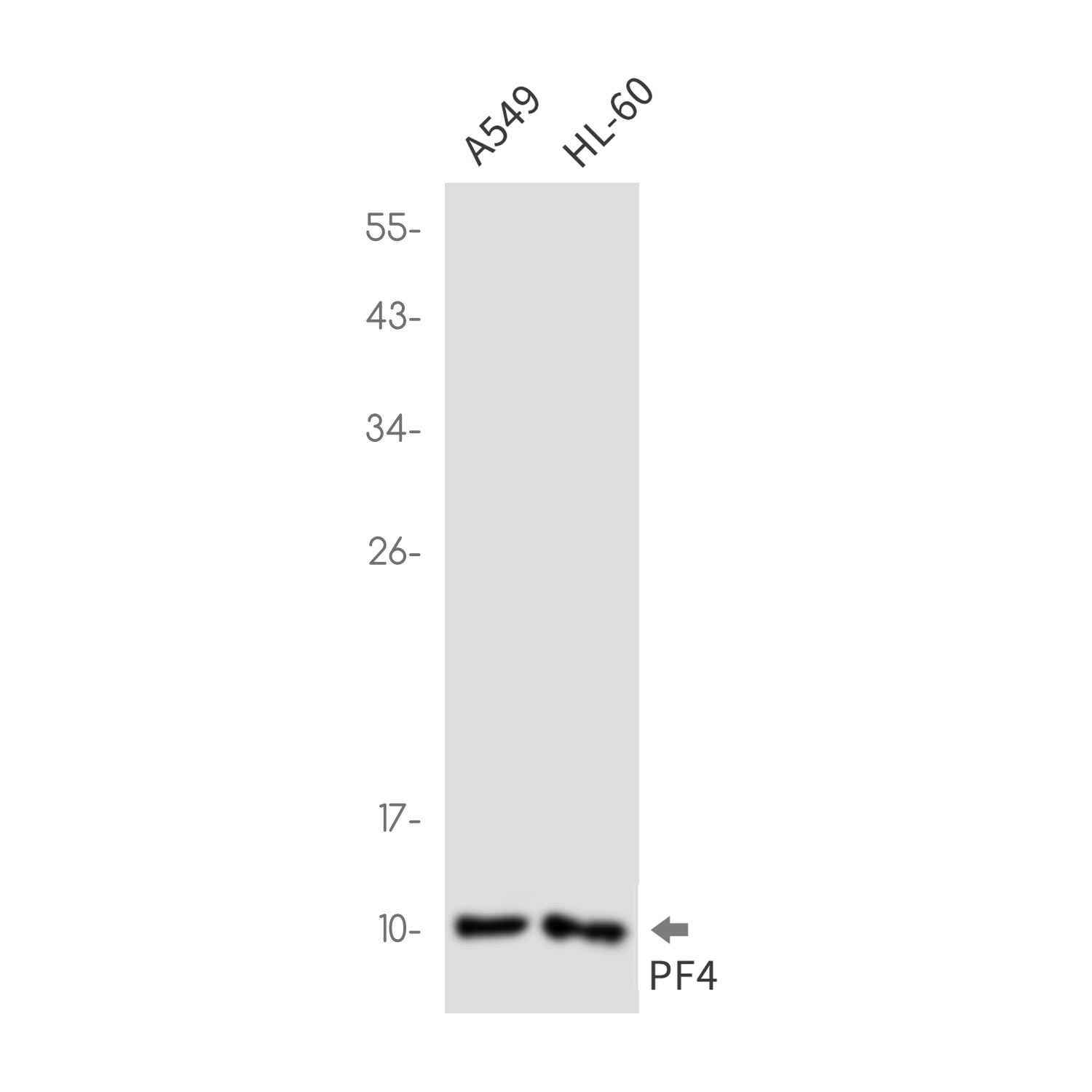 Rabbit Monoclonal Antibody to PF4