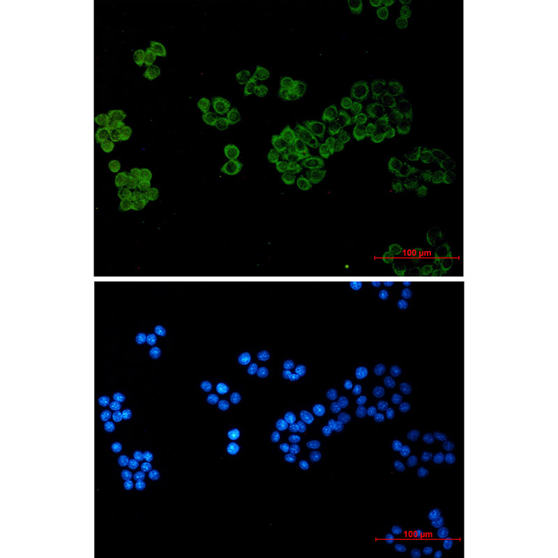 Rabbit Monoclonal Antibody to Phospholipase C gamma 1