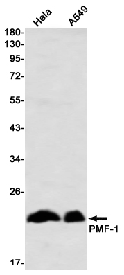 Rabbit Monoclonal Antibody to PMF 1