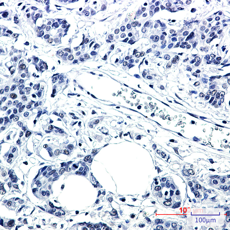Rabbit Monoclonal Antibody to PNKP
