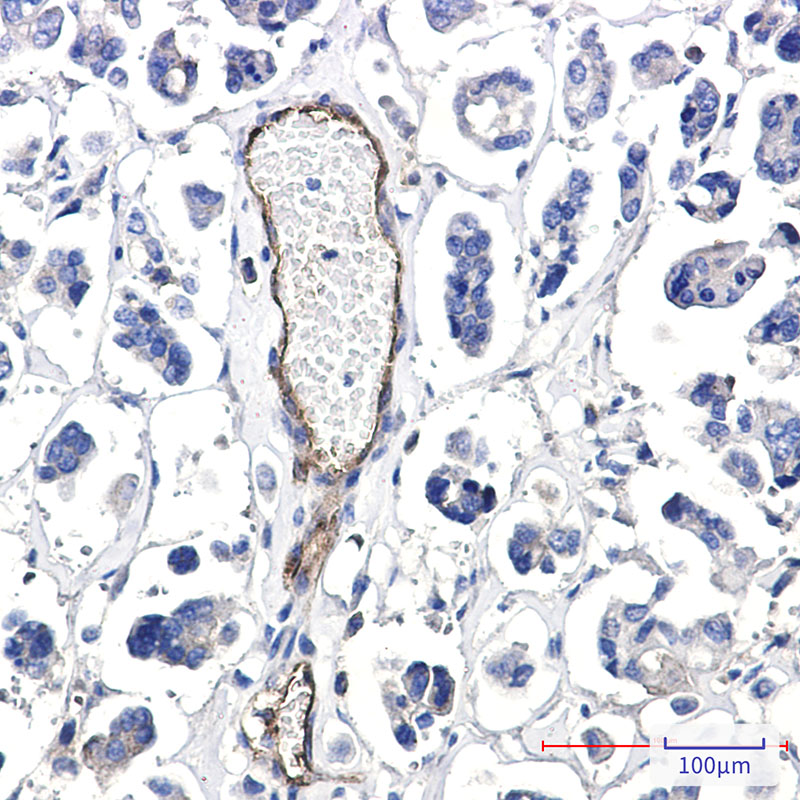 Rabbit Monoclonal Antibody to Poliovirus Receptor