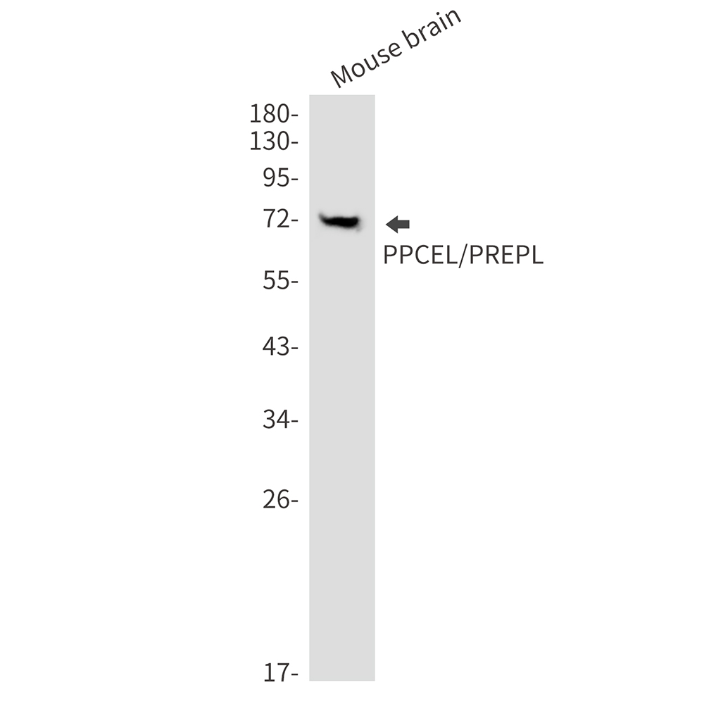 PPCEL