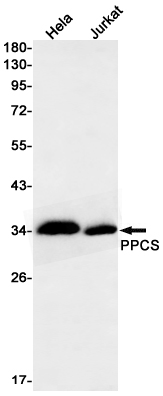 PPCS