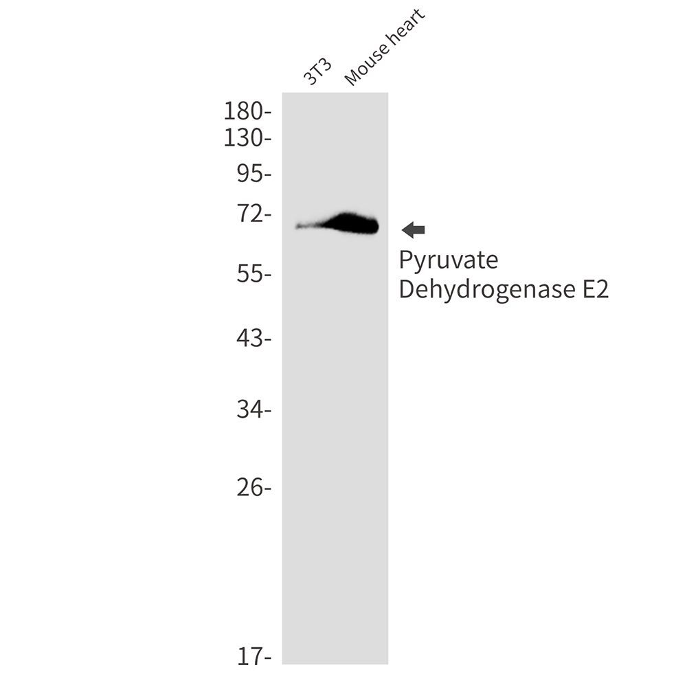 Pyruvate Dehydrogenase E2