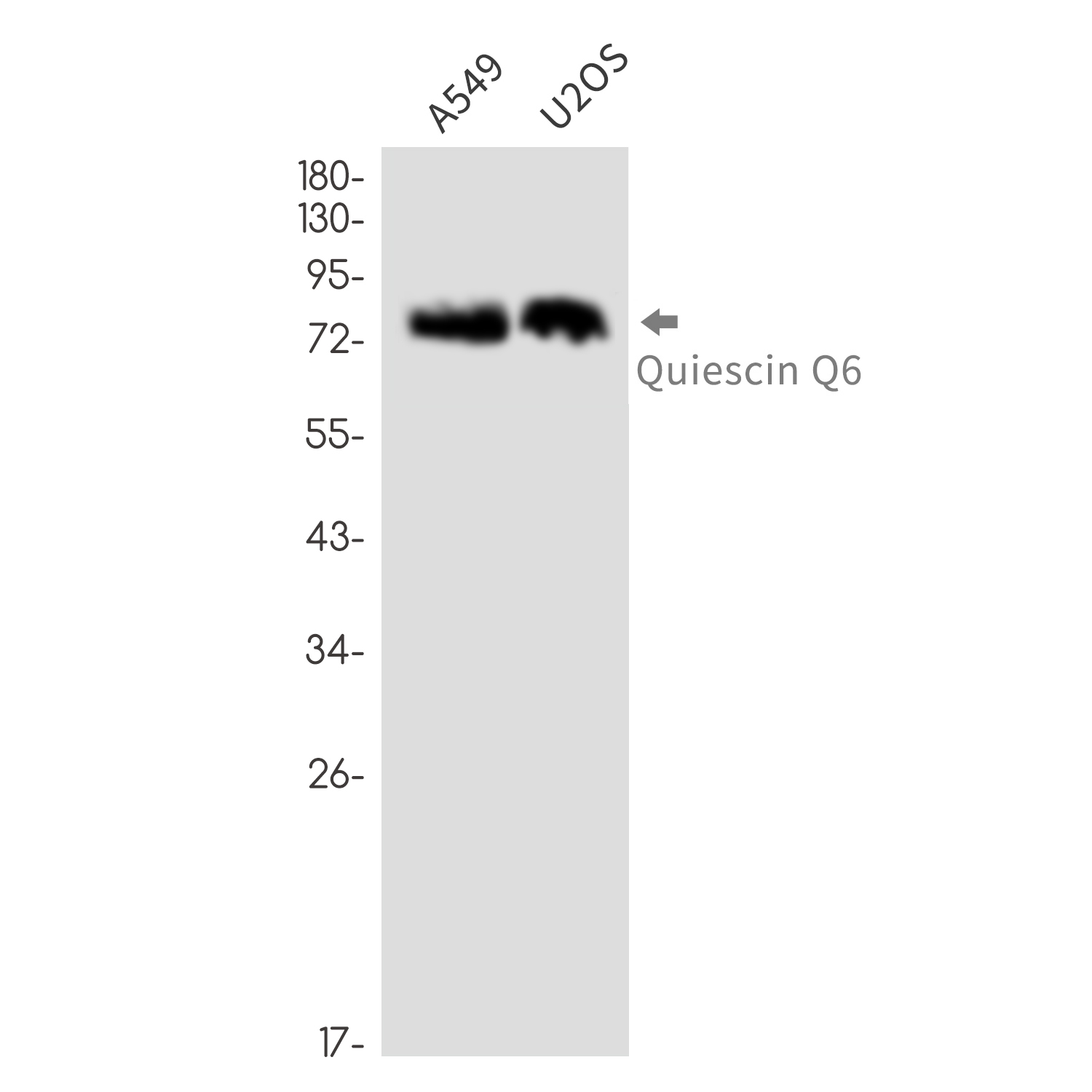 QSOX1
