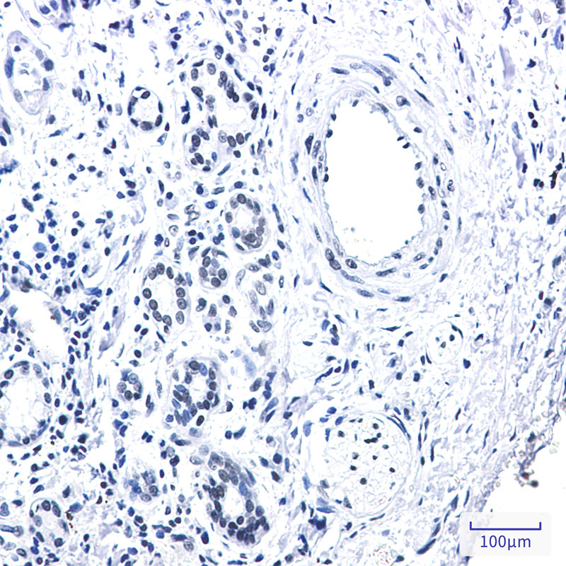 Rabbit Monoclonal Antibody to Rad21
