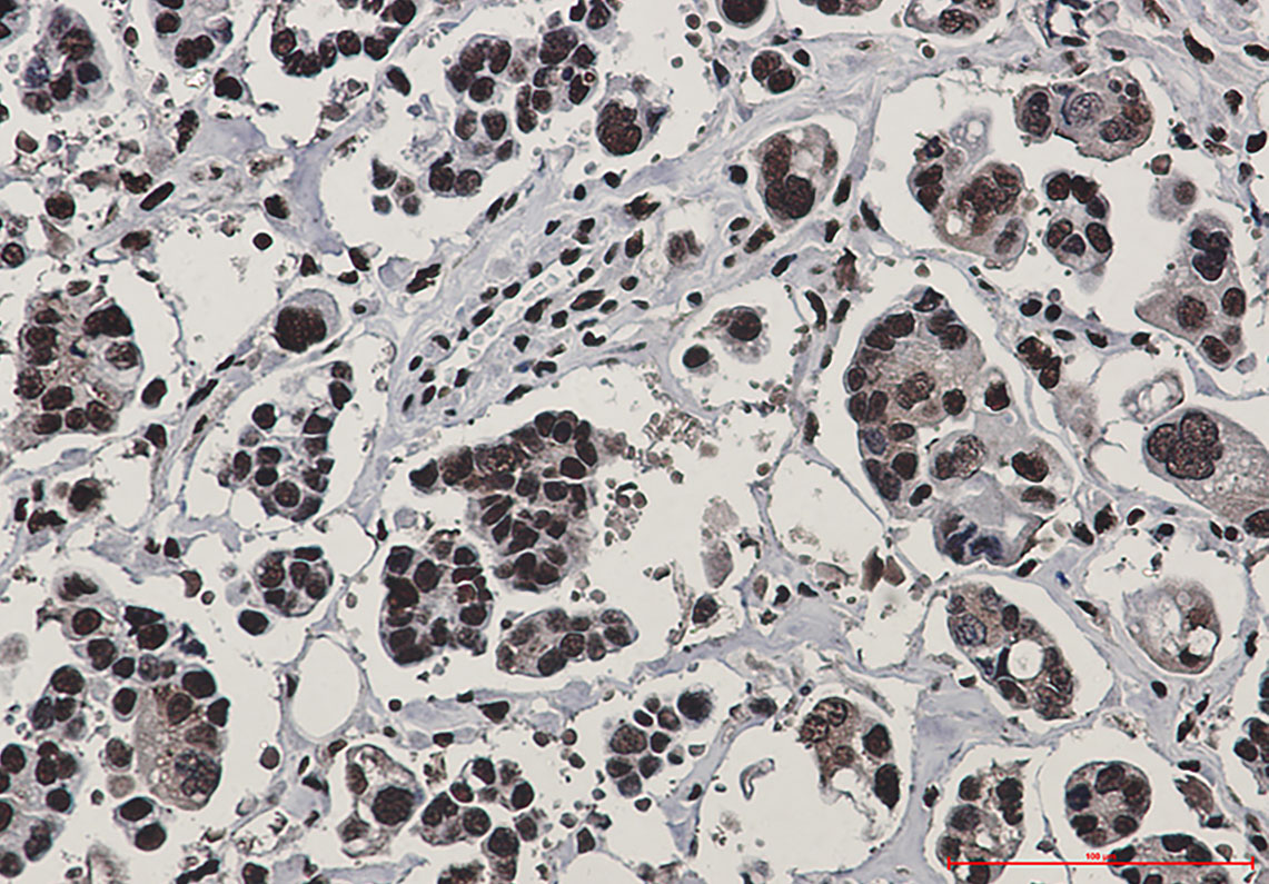 Rabbit Monoclonal Antibody to Rad50