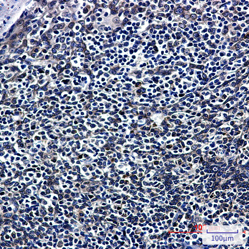 Rabbit Monoclonal Antibody to RanGAP1