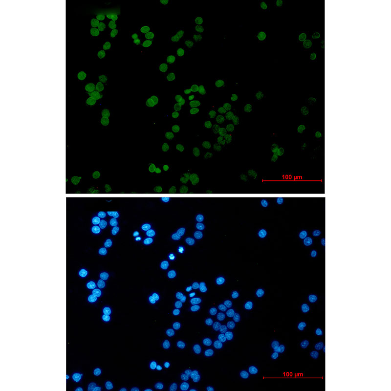 Rabbit Monoclonal Antibody to RAP80