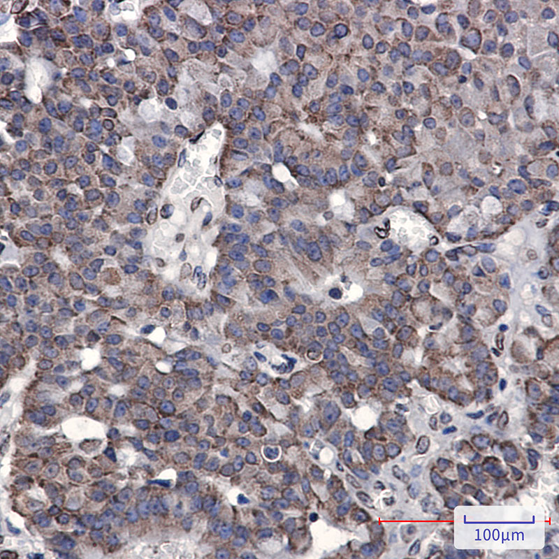 Rabbit Monoclonal Antibody to RAP80
