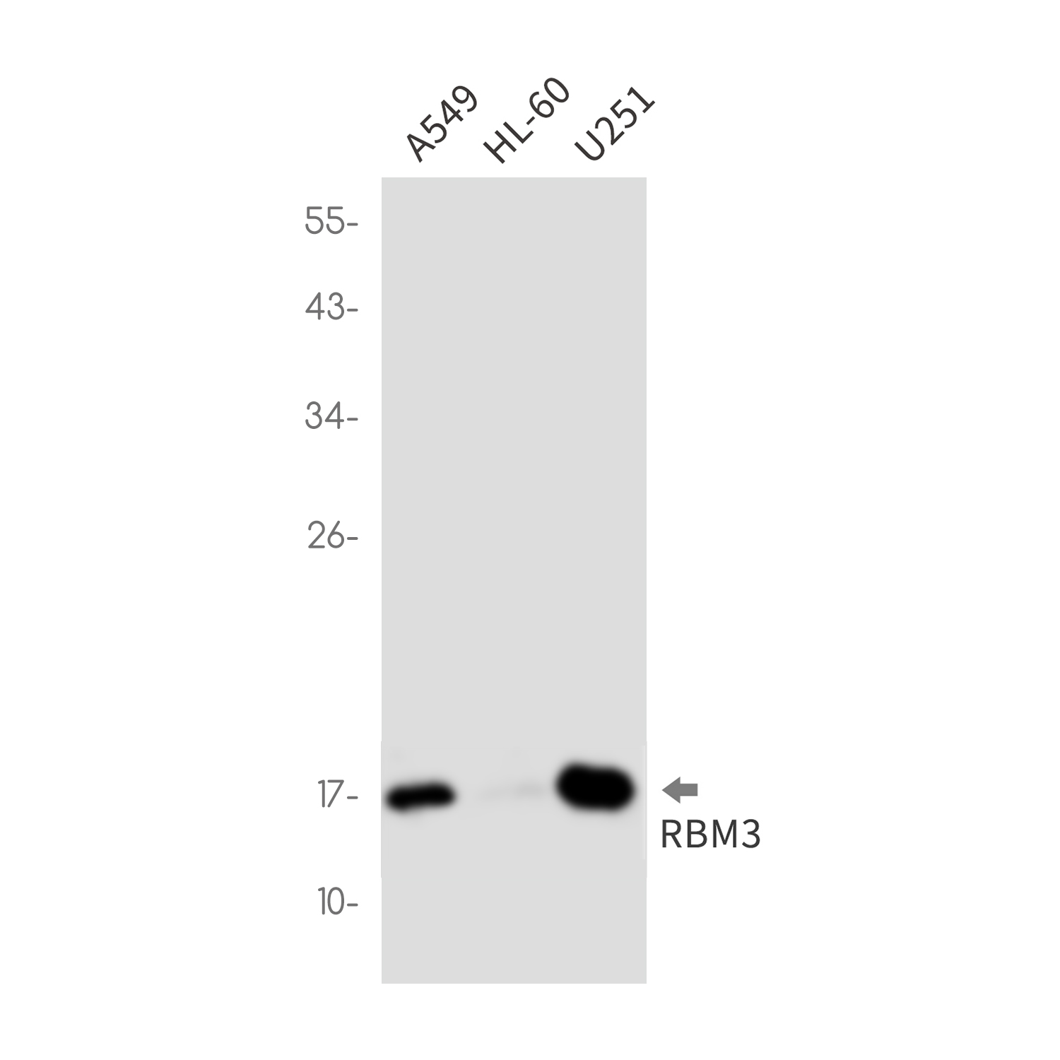 Rabbit Monoclonal Antibody to RBM3