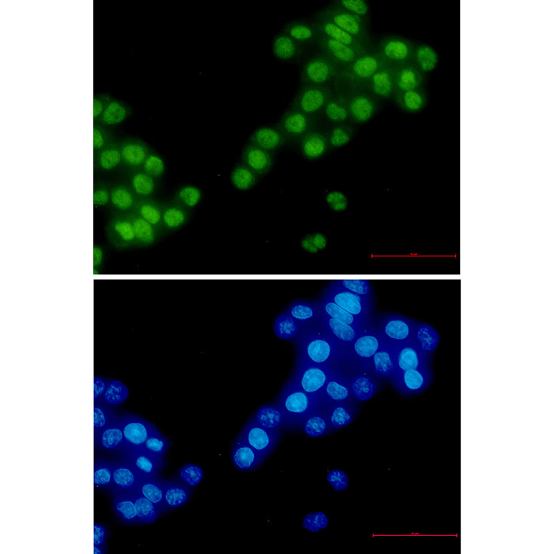 Rabbit Monoclonal Antibody to RBM3