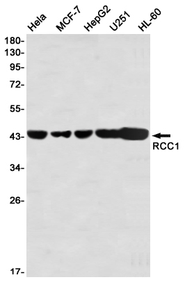 RCC1