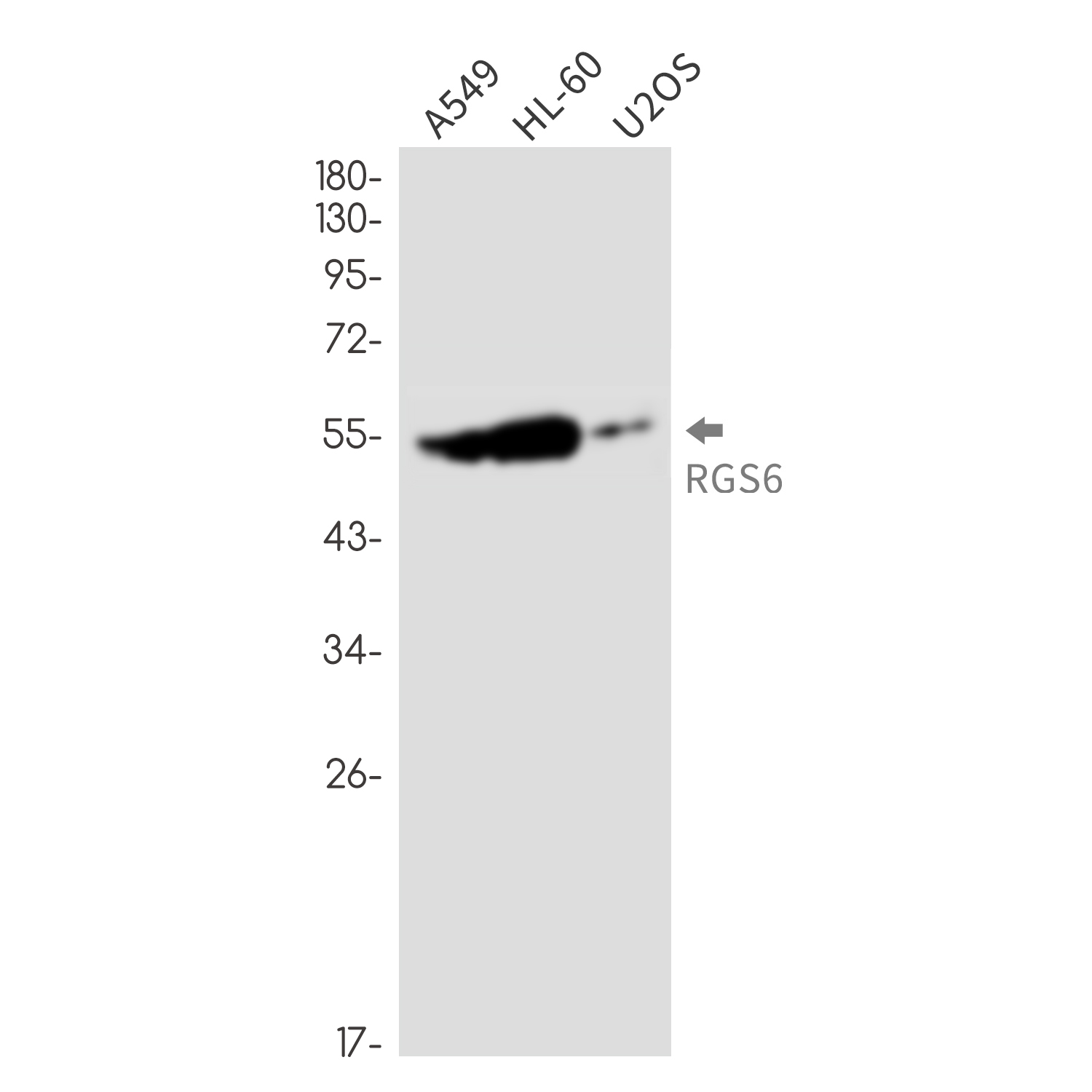 RGS6