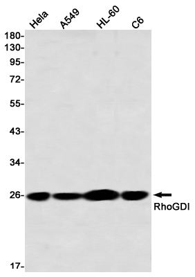 Rabbit Monoclonal Antibody to RhoGDI
