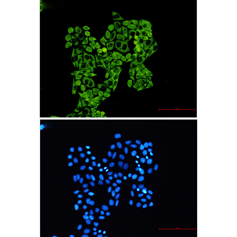 Rabbit Monoclonal Antibody to RPS8