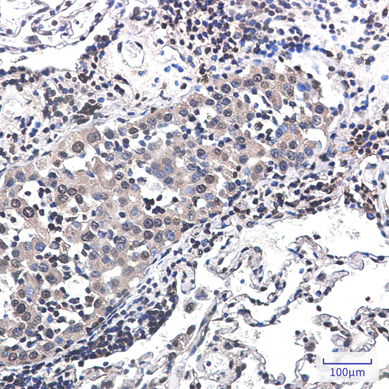 Rabbit Monoclonal Antibody to RSK2