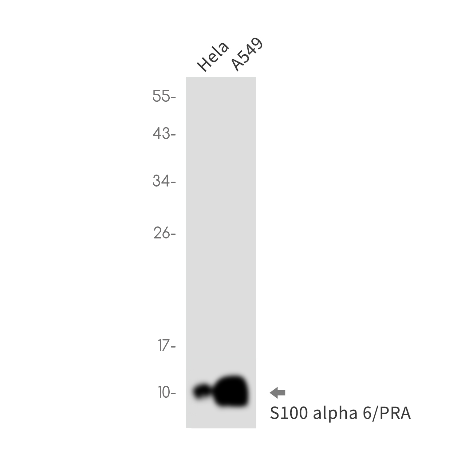 Rabbit Monoclonal Antibody to S100 alpha6