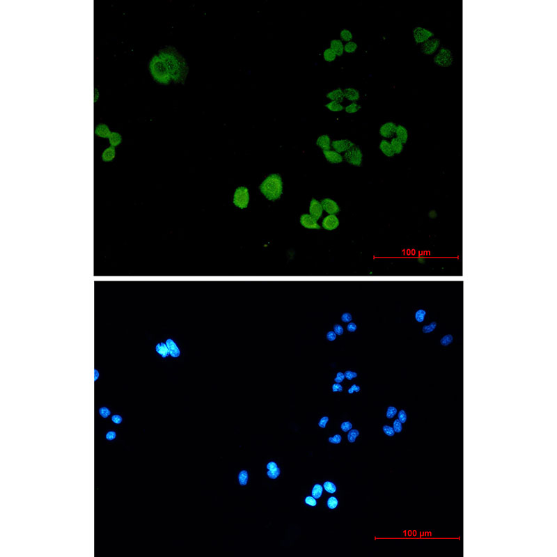 Rabbit Monoclonal Antibody to SBDS