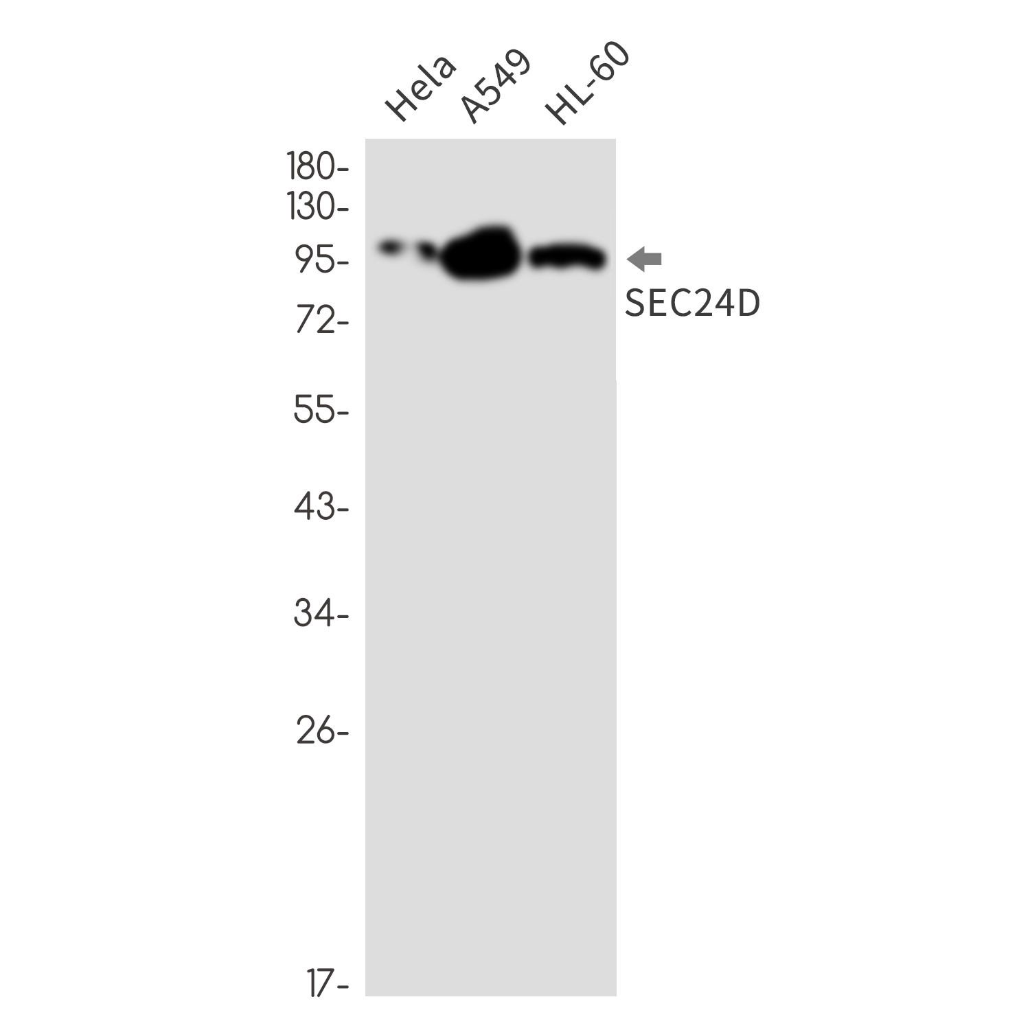 Rabbit Monoclonal Antibody to SEC24D