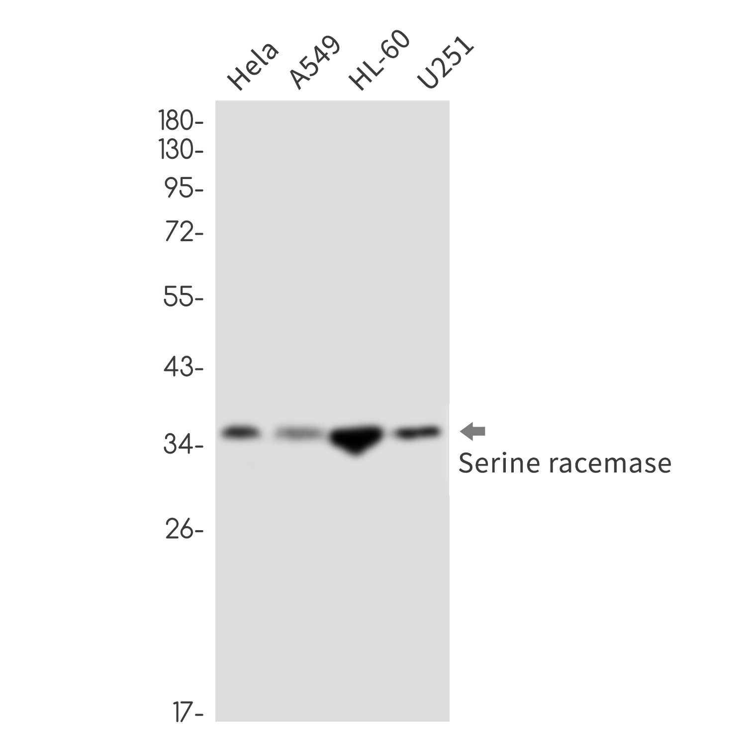 Serine Racemase
