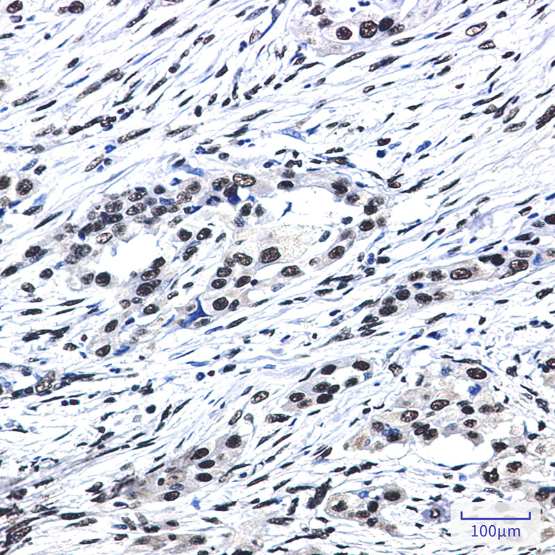Rabbit Monoclonal Antibody to SF3B1