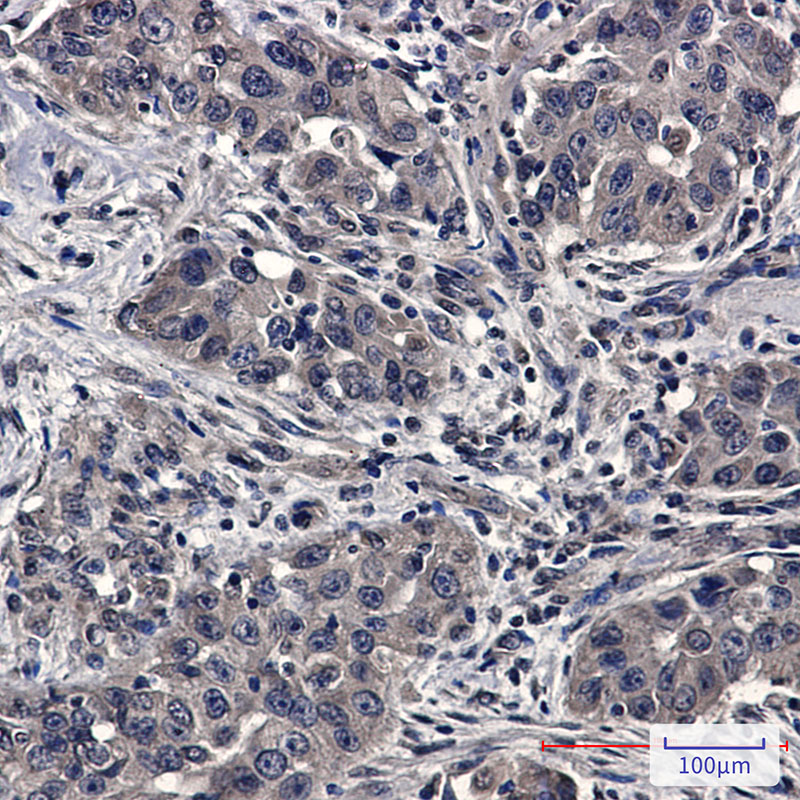 Rabbit Monoclonal Antibody to SFT