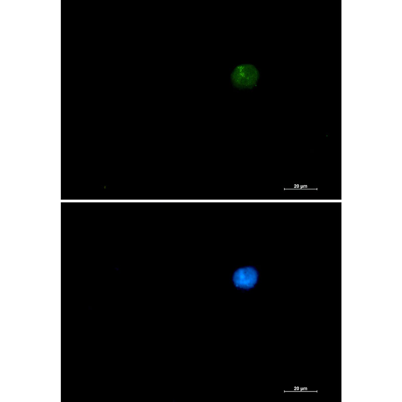 Rabbit Monoclonal Antibody to SMARCA2