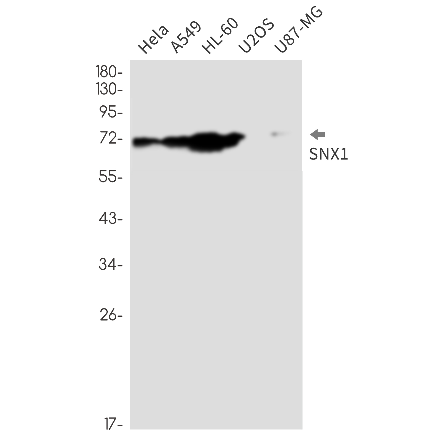 SNX1
