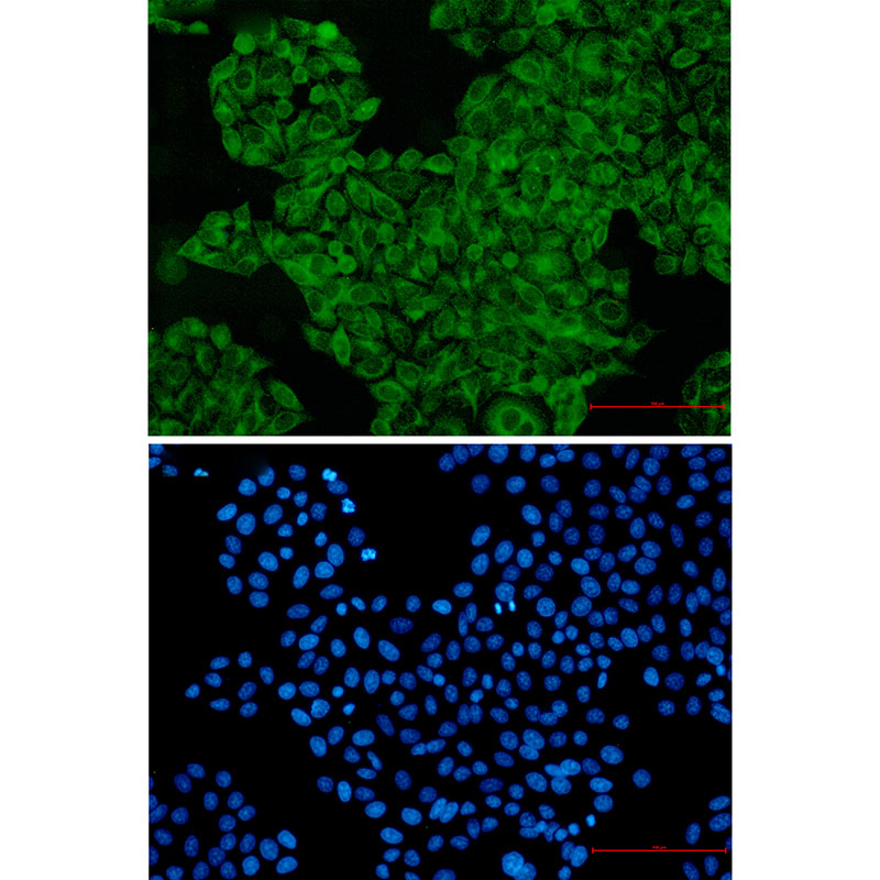 Rabbit Monoclonal Antibody to SNX1