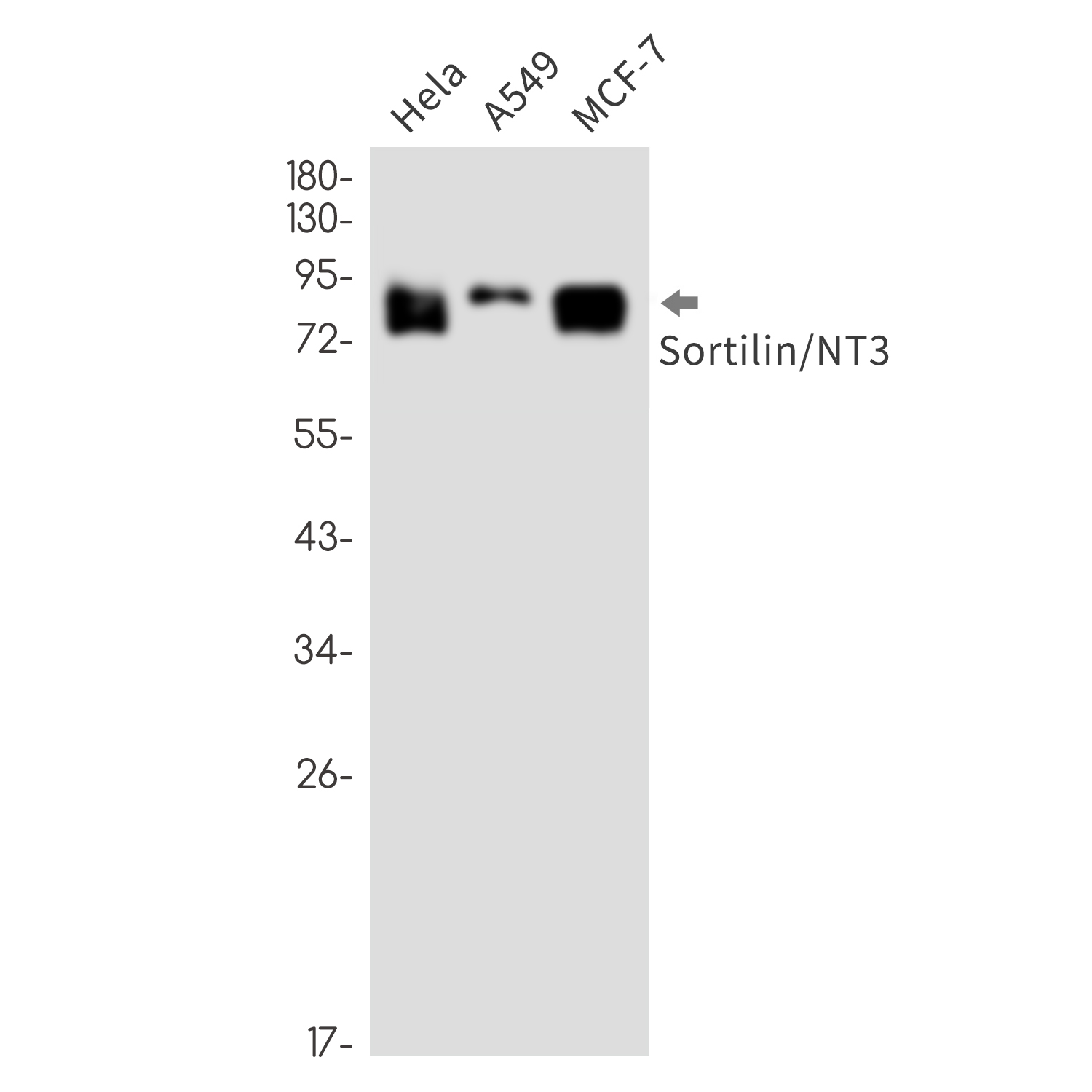 Rabbit Monoclonal Antibody to Sortilin