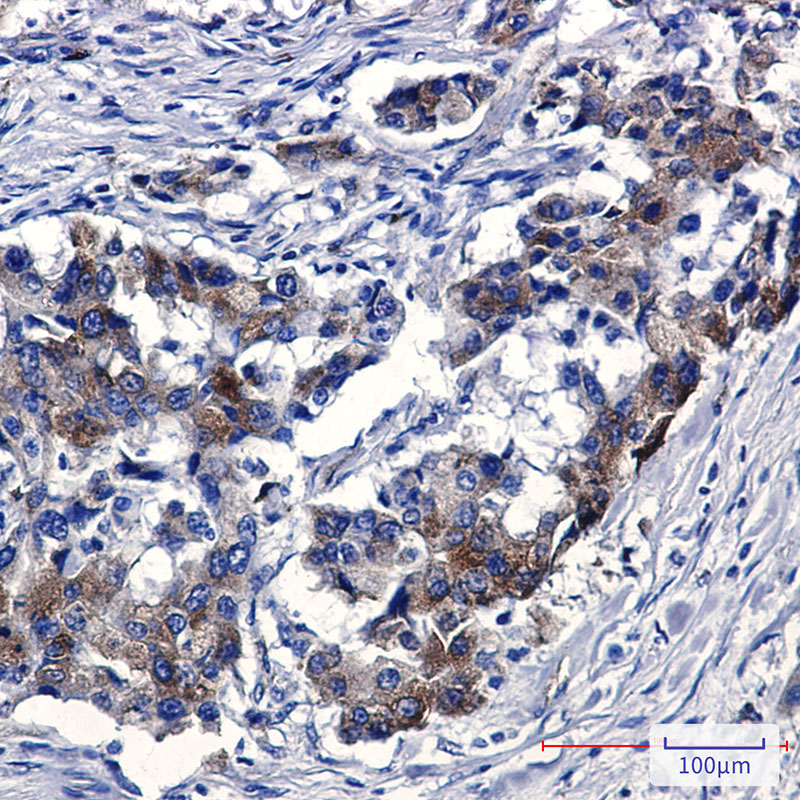 Rabbit Monoclonal Antibody to Sortilin